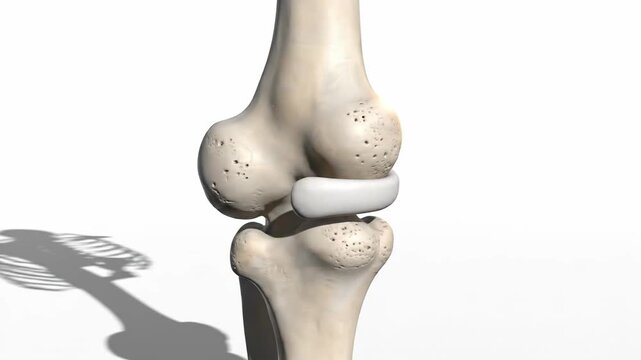 3D animation of the human lateral epicondyle of the femur, showing articulation with the tibia and patella.