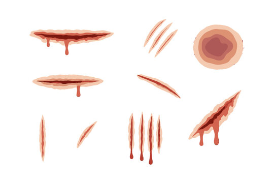 Realistic bloody wounds, deep cuts, scratches, and bruises for horror effects