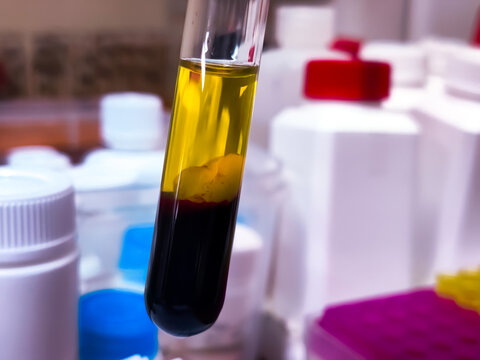 Serum and blood cell in glass test tube. It's a clear, yellowish fluid that remains after blood has clotted. - Powered by Adobe