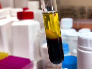 Serum and blood cell in glass test tube. It's a clear, yellowish fluid that remains after blood has clotted. 