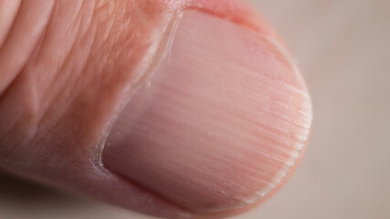 Close-up of fingernail plate with visible nail bed structure