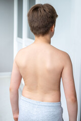 Naklejka premium Child's back showing spinal curvature comparison, scoliosis pain, kyphosis, orthopedic treatment or physical therapy, Posture correction growing bodies and spinal health, anatomy Medical illustration