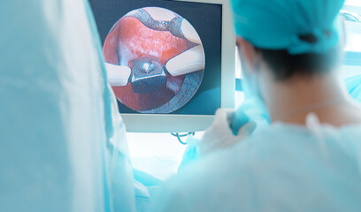 Male laparoscopy procedure for prostate adenoma in surgical setting