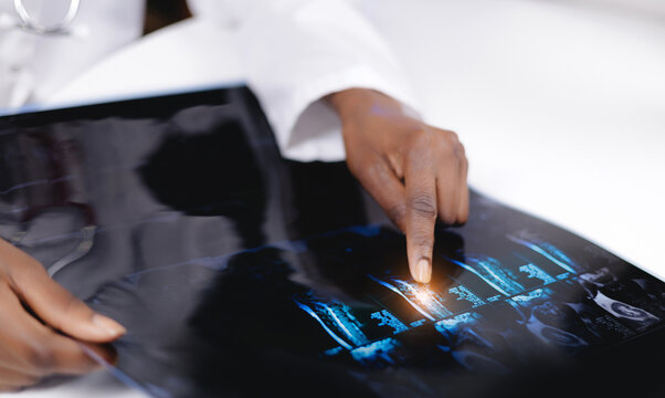 African female doctor analyzing Mri scan of spine showing disc protrusion in vertebral column on white background, banner