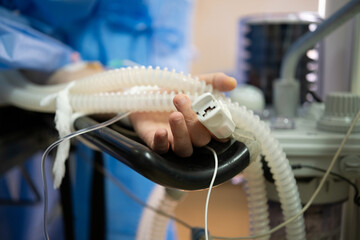 Patient's hand monitored by a pulse oximeter during surgery, with an anesthesia ventilator tube lying next to it, ensuring essential medical care and vital sign tracking in a hospital setting