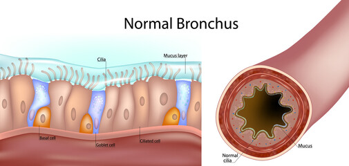 Structure of a normal human bronchus. Cross-section of the airway and a close-up of the pseudostratified ciliated epithelium with ciliated cells, goblet cells, basal cells, and the mucus layer. 