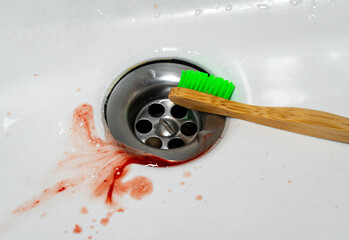 Bleeding Gums While Brushing Teeth, Toothbrush and Blood in Bathroom Sink