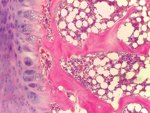 Detailed Micrograph of Developing Skeletal Tissue: Hyaline Cartilage Transitioning to Bone Trabeculae and Bone Marrow Cavit