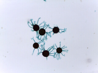 Detailed Microscopy of Powdery Mildew Fungi Sexual Stage: Spherical Ascocarp with Terminal Appendages for Species Identificat