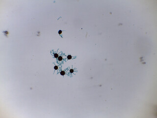 Detailed Microscopy of Powdery Mildew Fungi Sexual Stage: Spherical Ascocarp with Terminal Appendages for Species Identificat