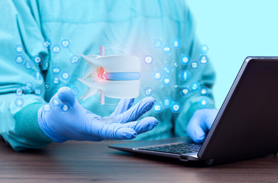 An orthopedic specialist reviews data on a lumbar disc herniation using a laptop. Concept of spinal diagnosis, nerve compression assessment, and modern digital lumbar health