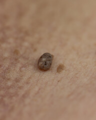 A small brown object is on a person's arm
