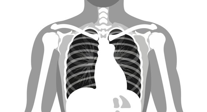 An Xray view of a torso reveals ribcage lungs clavicles shoulder bones humerus sternum and trachea in shades of gray