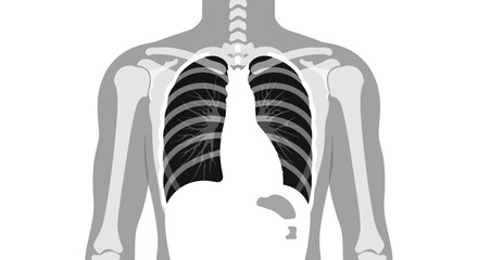 Illustration of a torso showing lungs ribs spine shoulders arms and stomach contents