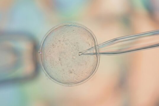 Egg cell receiving a microinjection with a delicate micropipette aiding fertility treatment and human reproduction, symbolizing medical advancement and future life