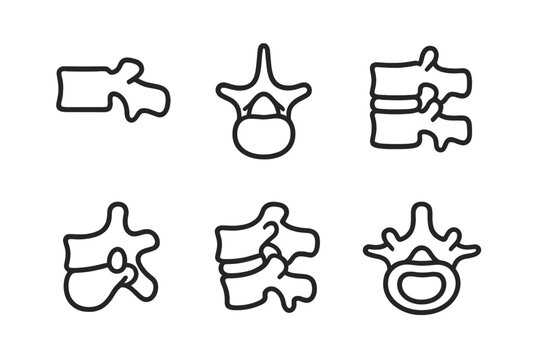Spinal Anatomy Icons. Spinal Anatomy Set linear icon set: vertebral body, spinous process, intervertebral disc, nerve opening, facet joint, spinal canal