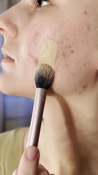 Girl applying foundation with a makeup brush, covering blemish-prone skin. Close-up skincare and beauty routine showing imperfect skin and natural coverage.
