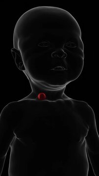 X-Ray video of Branchial cleft cyst in baby | Branchial cleft cyst Video in X-Ray | Branchial cleft cyst indication video in Vertical format