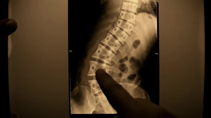 Doctor examining spine X-ray film with finger pointing at backbone detail