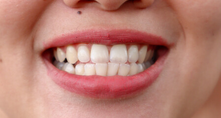 Asian Young woman with healthy teeth and beautiful smile, closeup