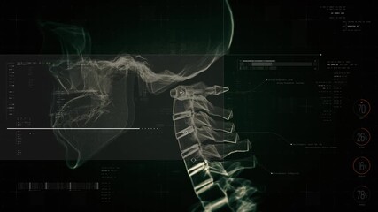 Biotech X-ray scan of cervical spine with digital HUD diagnostics, neural pathways, and medical interface overlays, creating a futuristic healthcare and anatomy visualization - Powered by Adobe