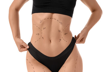 Young woman in underwear with marks on her body against white background. Liposuction concept