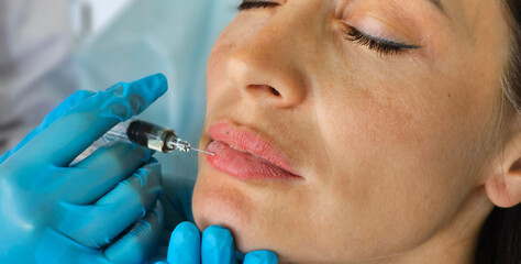  Woman Receiving a Lip Injection at a Medical Clinic