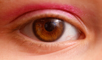 Obraz premium A woman's eye with a pinkish tint