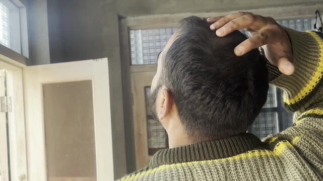 Young man showing his balding scalp, male pattern baldness, androgenic alopecia. concerned man examining his thinning hair and massaging his scalp, showing a bald spot and alopecia symptoms.