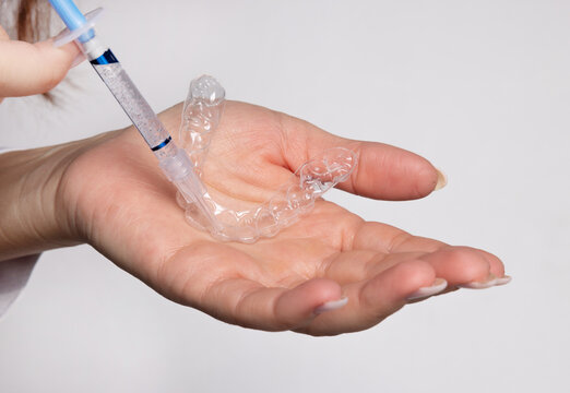 Woman holds whitening trays and solution on a minimal backdrop. Clear trays, dental model, case and syringes placed on the table. The woman applies gel into the trays for tooth care and bright smile.