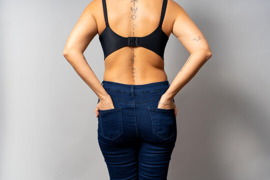 Woman showing body fat on back while wearing jeans
