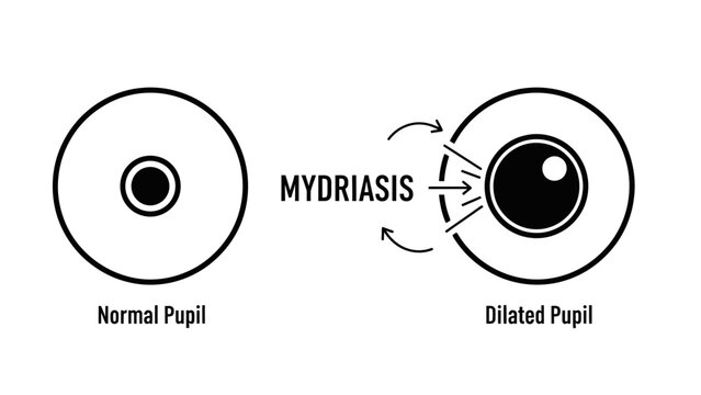 Mydriasis Dilated Pupil Eye Condition Icon
