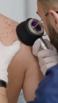 Vertical cropped shot of unrecognizable male doctor holding dermatoscope and inspecting skin disease on bare shoulders of unrecognizable patient in clinic