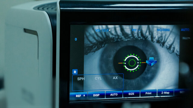 Close-up of a human eye being meticulously examined by advanced ophthalmology