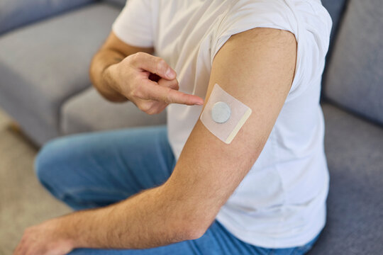 Man pointing at continuous glucose sensor patch on arm to control and measure blood sugar level in diabetes. Male patient using wearable medical device on hand, adult monitoring health at home