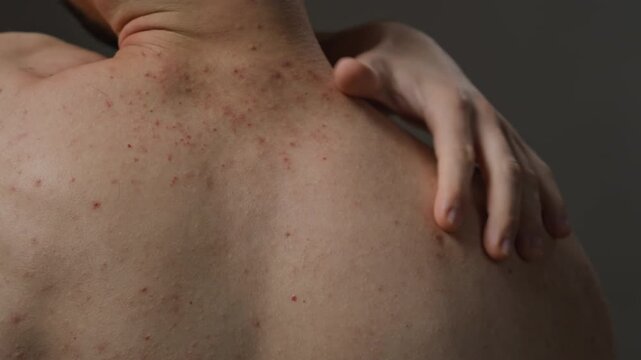 Rear view tilt up shot of unrecognizable man with bare back suffering from skin itching scratching shoulder while standing on minimal grey background in studio