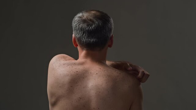 Chest up rear view shot of unrecognizable adult man scratching bare back suffering from skin irritation on minimal black background in studio
