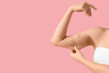 Arms of woman with marks on pink background. Liposuction concept