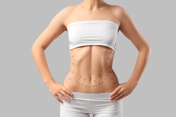 Young woman in underwear with marks on her belly against light background. Liposuction concept