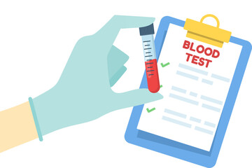 Vector of blood test and analysis, medical research with blood sample in test tube, laboratory examination, clinical study, diagnostics, and healthcare science illustration.