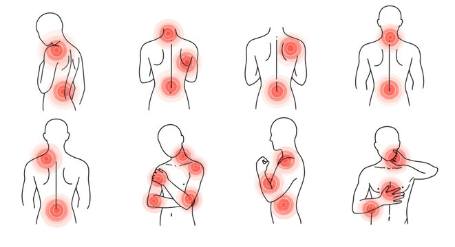 This medical illustration depicts various human figures experiencing pain in different parts of their body, highlighted by red circles on a clean white background.