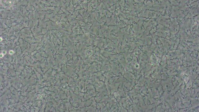 Rapid movement of single-celled spirilla bacteria under microscope magnification.
