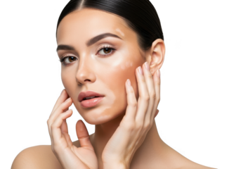 Woman with vitiligo touching her face isolated on transparent background
