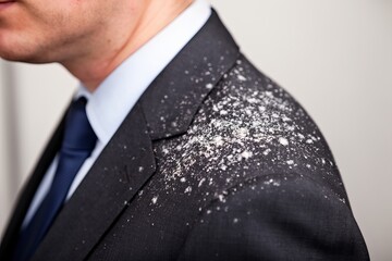 A close-up image of a business professional in a suit displaying dandruff on their shoulder.