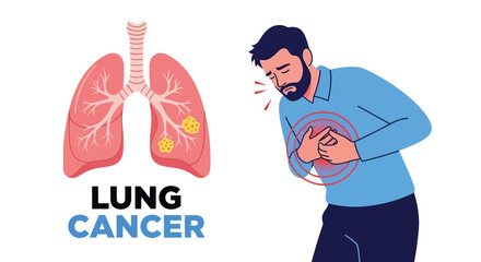 Lung cancer symptoms diagnosis treatment and prevention awareness