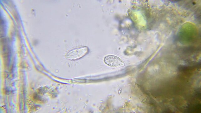 Two microbes surrounded by small motile bacteria, captured at 2000x brightfield microscopy with oil immersion, showing detailed microbial interactions.