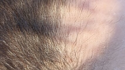 Close-up Hairline Detail Texture, Growth, and Edges for Medical Personal Care Visuals