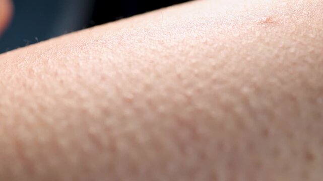 Skin shows goosebumps in response to cold air and other stimuli. View how the small bumps form on the surface and create texture on the skin.