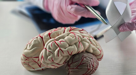 Doctor with grey ribbon and human brain anatomy model. Brain Cancer Awareness Month in May, World Brain Tumor Day, Brain Stroke, Dementia, Alzheimer's Disease,