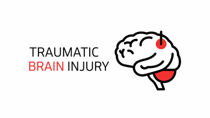 Vector illustration representing the concept of Traumatic Brain Injury (TBI), concussion, or head trauma.